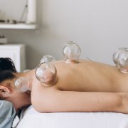 Acupuncture for Sports Recovery