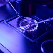 What are IVF Add-Ons