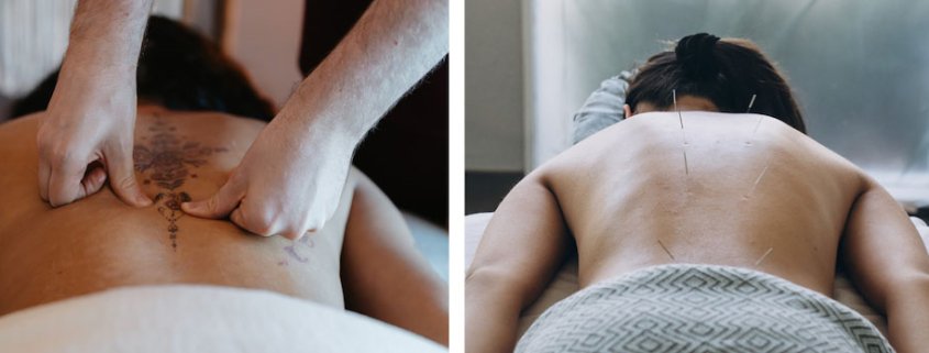 Deep Tissue Massage vs. Acupuncture